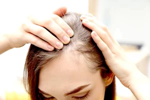 پیشرفت‌های علمی در درمان ریزش مو
